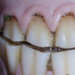 What is Good Dental Care Really Worth to you AND your Horse?